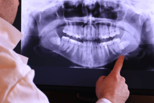 Best Emergency Tooth Extraction in Marcus, IA