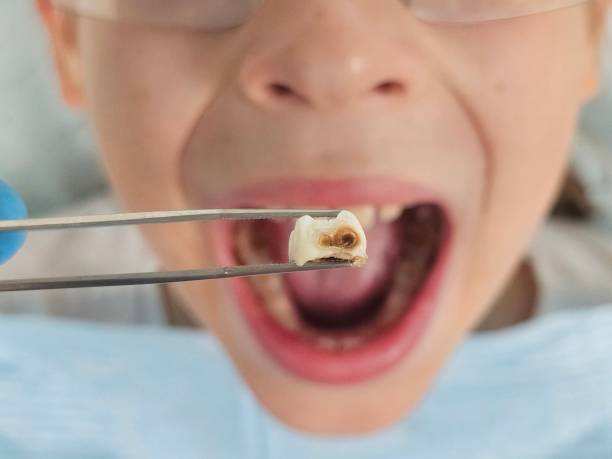 Best Same-Day Emergency Dental Services in Marcus, IA